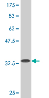 1 - WRB Antibody (monoclonal) (M05) AT4543a