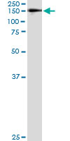5 - WWP1 Antibody (monoclonal) (M01) AT4546a