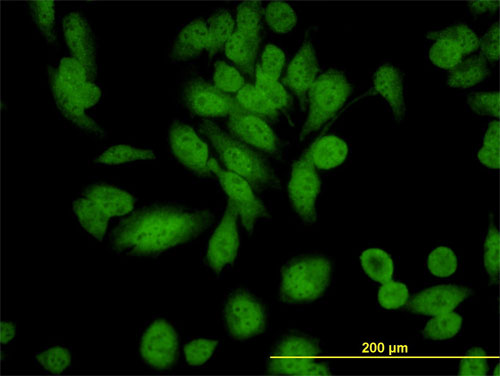 3 - XAB1 Antibody (monoclonal) (M01) AT4547a