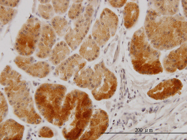 2 - XAB1 Antibody (monoclonal) (M01) AT4547a