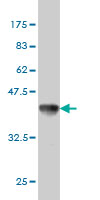 1 - XAB1 Antibody (monoclonal) (M01) AT4547a