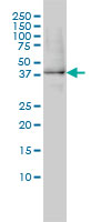 1 - XAB1 Antibody (monoclonal) (M01) AT4547a
