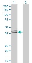 1 - XAB1 Antibody (monoclonal) (M01) AT4547a