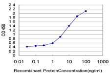 10 - XPC Antibody (monoclonal) (M01) AT4551a