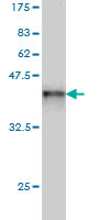 1 - XPC Antibody (monoclonal) (M01) AT4551a