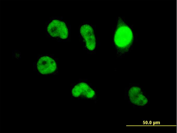 3 - ZBED1 Antibody (monoclonal) (M01) AT4568a