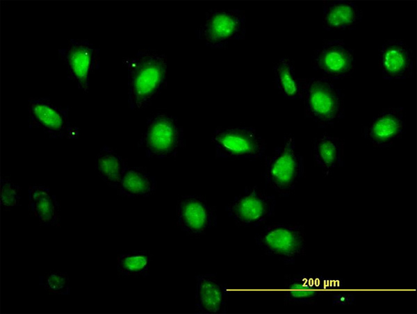 3 - ZFYVE19 Antibody (monoclonal) (M01) AT4575a