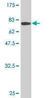 1 - ZFYVE19 Antibody (monoclonal) (M01) AT4575a