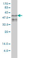1 - ZFYVE19 Antibody (monoclonal) (M01) AT4575a