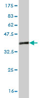 1 - ZIC1 Antibody (monoclonal) (M01) AT4578a