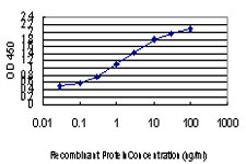10 - ZIC4 Antibody (monoclonal) (M01) AT4580a