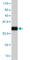 1 - ZNF124 Antibody (monoclonal) (M01) AT4586a