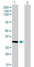 1 - ZNF124 Antibody (monoclonal) (M01) AT4586a