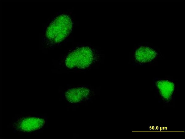 3 - ZNF131 Antibody (monoclonal) (M07) AT4587a