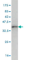1 - ZNF131 Antibody (monoclonal) (M07) AT4587a