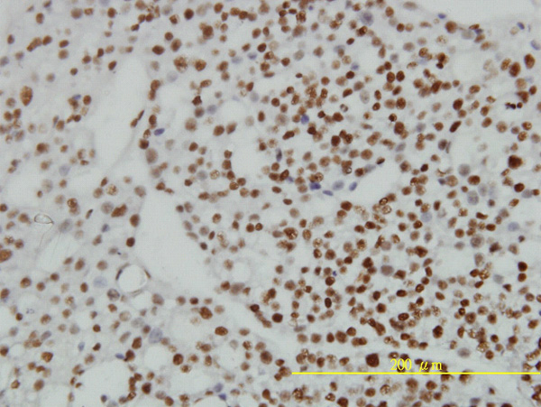 2 - ZNF143 Antibody (monoclonal) (M01) AT4590a