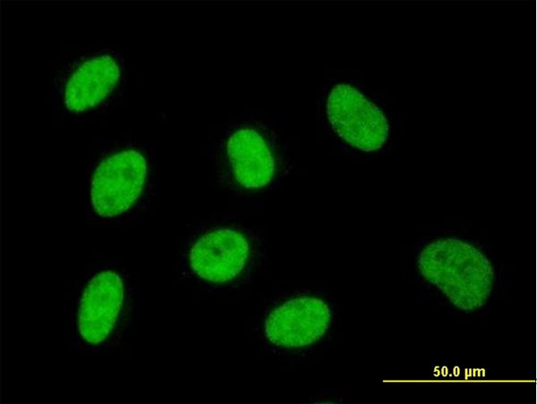 3 - ZNF143 Antibody (monoclonal) (M02) AT4591a