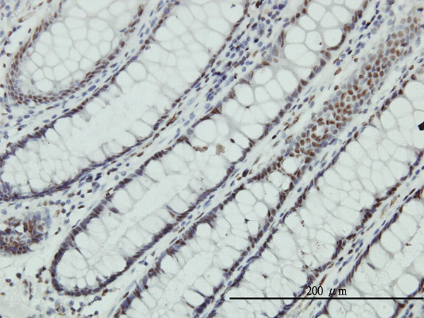 2 - ZNF143 Antibody (monoclonal) (M02) AT4591a