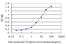 10 - ZNF174 Antibody (monoclonal) (M01) AT4592a