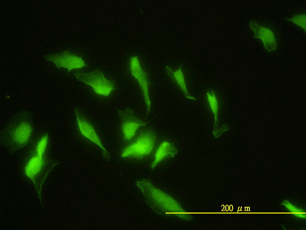 3 - ZNF174 Antibody (monoclonal) (M01) AT4592a