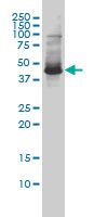 1 - ZNF174 Antibody (monoclonal) (M01) AT4592a