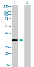 1 - ZNF174 Antibody (monoclonal) (M01) AT4592a