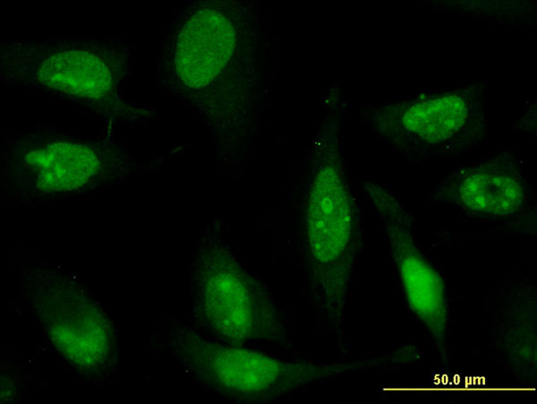 3 - ZNF181 Antibody (monoclonal) (M01) AT4594a