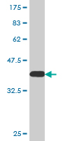1 - ZNF181 Antibody (monoclonal) (M01) AT4594a