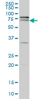 1 - ZNF181 Antibody (monoclonal) (M01) AT4594a