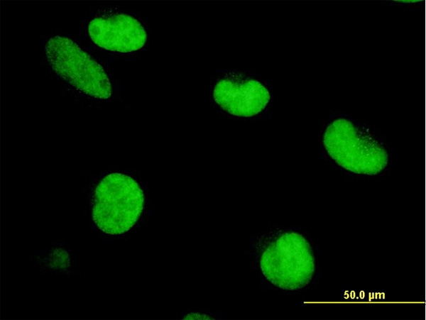 3 - ZNF207 Antibody (monoclonal) (M02) AT4598a