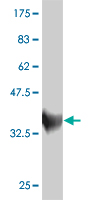 1 - ZNF207 Antibody (monoclonal) (M02) AT4598a
