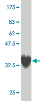 1 - ZNF207 Antibody (monoclonal) (M04) AT4600a