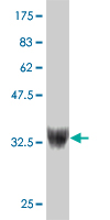 1 - ZNF207 Antibody (monoclonal) (M05) AT4601a