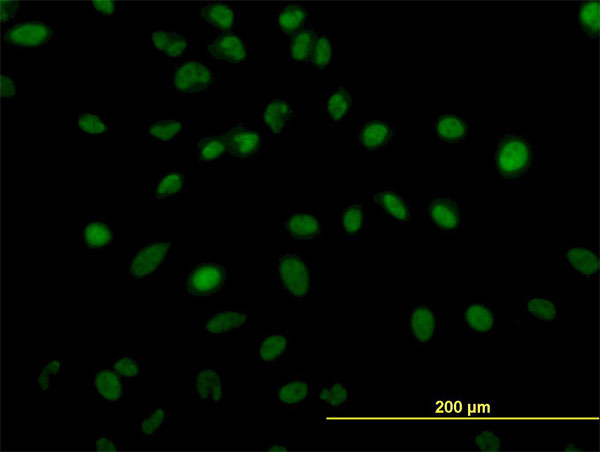 3 - ZNF207 Antibody (monoclonal) (M06) AT4602a