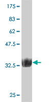 1 - ZNF207 Antibody (monoclonal) (M06) AT4602a