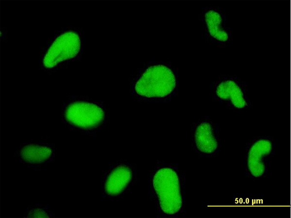 3 - ZNF207 Antibody (monoclonal) (M07) AT4603a