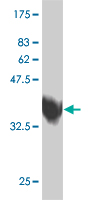 1 - ZNF207 Antibody (monoclonal) (M07) AT4603a