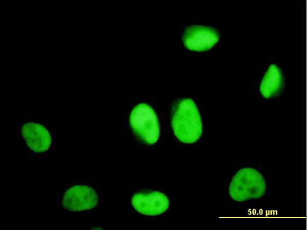 3 - ZNF207 Antibody (monoclonal) (M08) AT4604a