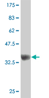 1 - ZNF207 Antibody (monoclonal) (M08) AT4604a