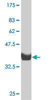 1 - ZNF207 Antibody (monoclonal) (M09) AT4605a