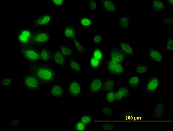 3 - ZNF21 Antibody (monoclonal) (M03) AT4606a