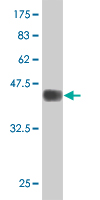 1 - ZNF21 Antibody (monoclonal) (M03) AT4606a