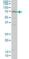 1 - ZNF21 Antibody (monoclonal) (M03) AT4606a