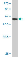 1 - ZNF215 Antibody (monoclonal) (M01) AT4609a