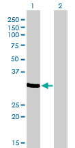 1 - ZNF215 Antibody (monoclonal) (M01) AT4609a