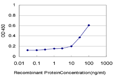 10 - ZNF215 Antibody (monoclonal) (M02) AT4610a