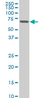 1 - ZNF215 Antibody (monoclonal) (M02) AT4610a