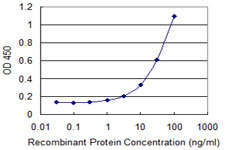 10 - ZNF232 Antibody (monoclonal) (M06) AT4611a