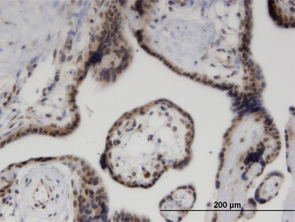 2 - ZNF232 Antibody (monoclonal) (M06) AT4611a