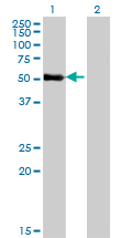 1 - ZNF232 Antibody (monoclonal) (M06) AT4611a